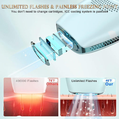 DEESS IPL Hair Removal Device Unisex: for both men and women, 0.9s/flash with smart automatic